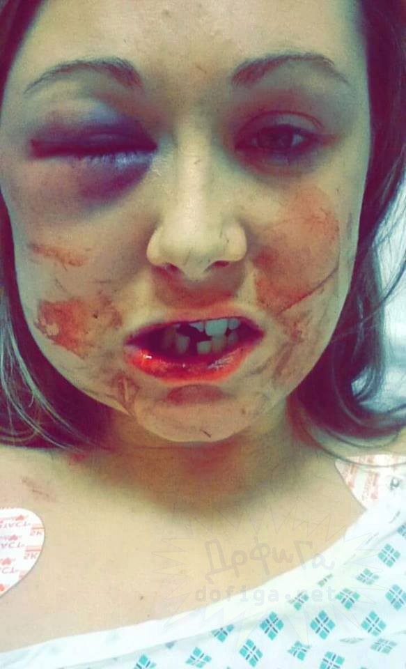 Секс хийхээс татгалзлаа хэмээн нүүрлүү нь 50 удаа цохижээ